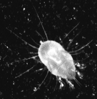 Picture of a Dust Mite